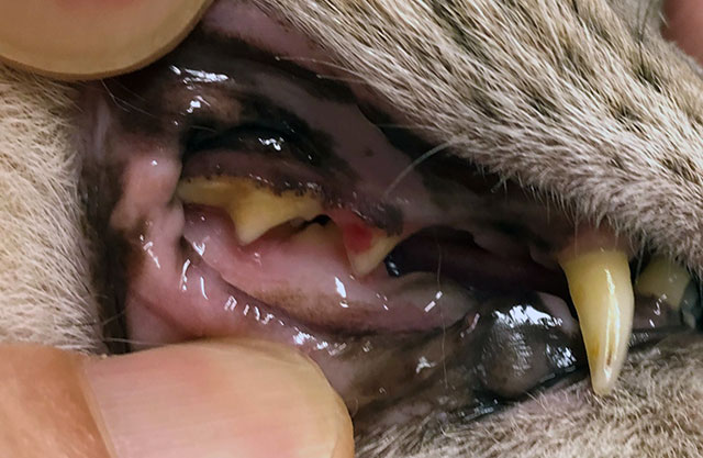 歯の吸収病巣